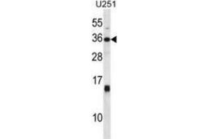 Western blot analysis in U251 cell line lysates (35ug/lane) using Stanniocalcin-1 / STC1 Antibody (C-term). (Stanniocalcin 1 抗体  (C-Term))