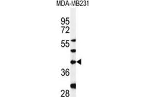 Western Blotting (WB) image for anti-Dolichyl-Phosphate (UDP-N-Acetylglucosamine) N-acetylglucosaminephosphotransferase 1 (GlcNAc-1-P Transferase) (DPAGT1) antibody (ABIN3004399) (DPAGT1 抗体)