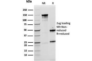 SDS-PAGE Analysis Purified LMO2 Mouse Monoclonal Antibody (rLMO2/1971). (Recombinant LMO2 抗体  (AA 23-140))