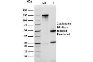 SDS-PAGE Analysis Purified LMO2 Mouse Monoclonal Antibody (rLMO2/1971).