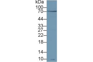 Detection of zAP70 in Human Jurkat cell lysate using Polyclonal Antibody to Zeta Chain Associated Protein Kinase 70 kDa (zAP70) (ZAP70 抗体  (AA 337-600))