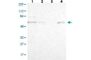 Western blot analysis of Lane 1: Human cell line RT-4 Lane 2: Human cell line U-251MG sp Lane 3: Human plasma (IgG/HSA depleted) Lane 4: Human liver tissue with ZNF550 polyclonal antibody . (ZNF550 抗体)