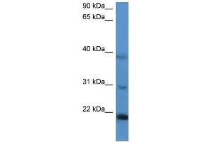 WB Suggested Anti-IMMP2L Antibody Titration: 0. (IMMP2L 抗体  (N-Term))