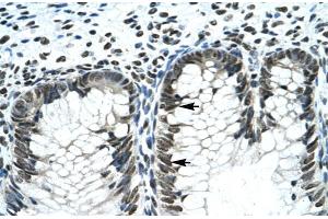 Rabbit Anti-GLI2 Antibody  Paraffin Embedded Tissue: Human Intestine Cellular Data: Epithelial cells of intestinal gland Antibody Concentration: 4. (GLI2 抗体  (Middle Region))