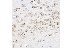 Immunohistochemistry of paraffin-embedded mouse brain using RPL4 Rabbit pAb (ABIN6129106, ABIN6147145, ABIN6147146 and ABIN6221591) at dilution of 1:100 (40x lens). (RPL4 抗体  (AA 1-240))