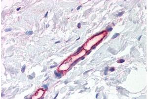 Human Breast, Vessels (formalin-fixed, paraffin-embedded) stained with PLXDC1 antibody ABIN337391 at 2. (PLXDC1 抗体  (AA 411-427))
