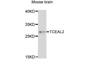 Western blot analysis of extracts of mouse brain, using TCEAL2 antibody (ABIN6293088) at 1:3000 dilution. (TCEAL2 抗体)