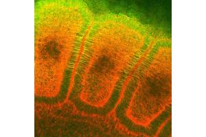 Immunohistochemistry analysis using Mouse Anti-Hsp27 Monoclonal Antibody, Clone 8A7 . (HSP27 抗体  (APC))