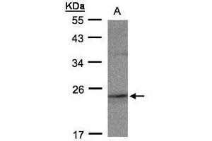 WB Image Sample(30 ug whole cell lysate) A:MOLT4 , 12% SDS PAGE antibody diluted at 1:500 (RAP2C 抗体)