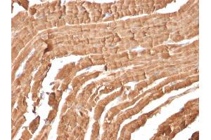 Formalin-fixed, paraffin-embedded Mouse Heart stained with Myoglobin Mouse Monoclonal Antibody (MB/2105). (Myoglobin 抗体)