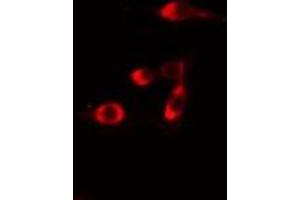 ABIN6275708 staining  Hela cells by IF/ICC. (RAD51C 抗体  (Internal Region))