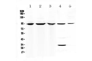 Western blot analysis of Complement C7 using anti-Complement C7 antibody . (C7 抗体  (AA 233-453))