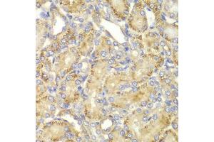 Immunohistochemistry of paraffin-embedded rat kidney using PPP2R2A antibody. (PPP2R2A 抗体)