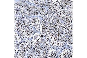 IHC analysis of SF3B3 using anti-SF3B3 antibody (ABIN7602378).