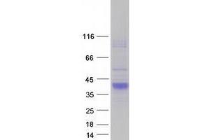 Western Blotting (WB) image for Sodium Channel, Voltage-Gated, Type III, beta Subunit (SCN3B) (Transcript Variant 2) protein (Myc-DYKDDDDK Tag) (ABIN2731493)