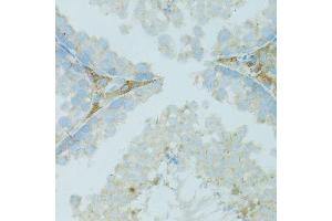 Immunohistochemistry (Paraffin-embedded Sections) (IHC (p)) image for anti-Tight Junction Protein 2 (Zona Occludens 2) (TJP2) (AA 951-1190) antibody (ABIN1683322)