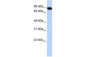 WB Suggested Anti-CREBL1 Antibody Titration: 0. (ATF6B 抗体  (Middle Region))