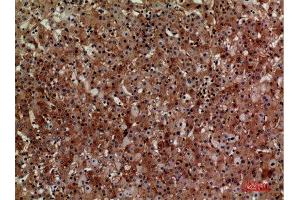 Immunohistochemistry (IHC) analysis of paraffin-embedded Human Liver, antibody was diluted at 1:100. (CD276 抗体  (Internal Region))