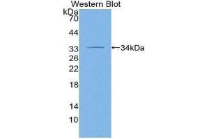 Western Blotting (WB) image for anti-Adenylate Cyclase 1 (Brain) (ADCY1) (AA 303-569) antibody (ABIN3206814) (ADCY1 抗体  (AA 303-569))