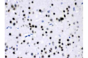 MEF2A was detected in paraffin-embedded sections of rat brain tissues using rabbit anti- MEF2A Antigen Affinity purified polyclonal antibody (Catalog # ) at 1 µg/mL.