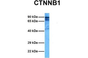 Host:  Rabbit  Target Name:  CTNNB1  Sample Tissue:  Human MCF7  Antibody Dilution:  1.