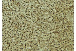 ABIN6273215 at 1/100 staining Mouse liver tissue by IHC-P.