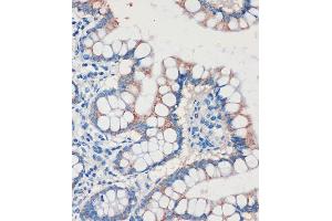 Immunohistochemistry of paraffin-embedded Human colon using CHDH Rabbit pAb (ABIN7266341) at dilution of 1:100 (40x lens). (CHDH 抗体  (AA 245-594))