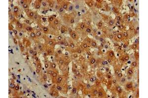Immunohistochemistry of paraffin-embedded human liver tissue using ABIN7157050 at dilution of 1:100
