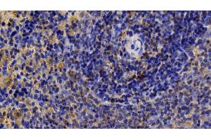 Immunohistochemistry (IHC) image for anti-Mitogen-Activated Protein Kinase 8 (MAPK8) (AA 138-370) antibody (ABIN7439327)