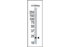 Image no. 1 for anti-ISG15 Ubiquitin-Like Modifier (ISG15) (AA 39-68), (N-Term) antibody (ABIN356679) (ISG15 抗体  (N-Term))