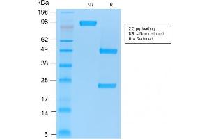 SDS-PAGE Analysis Purified CD86 Mouse Recombinant Monoclonal Antibody (rC86/1146).