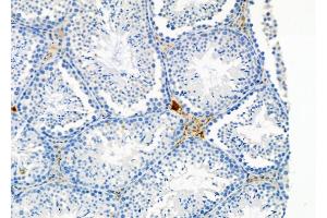 ABIN6264292 and ABIN6278946 at 1/100 staining Mouse testis tissue by IHC-P. (PLCH2 抗体  (N-Term))
