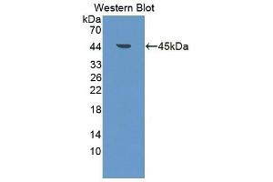 Detection of Recombinant BNIP3, Rat using Polyclonal Antibody to Bcl2/Adenovirus E1B 19 kDa Interacting Protein 3 (BNIP3) (BNIP3 抗体  (AA 3-134))