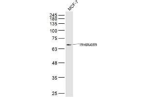 MCF7 lysates probed with Involucrin Polyclonal Antibody, Unconjugated  at 1:300 dilution and 4˚C overnight incubation. (Involucrin 抗体  (AA 21-120))