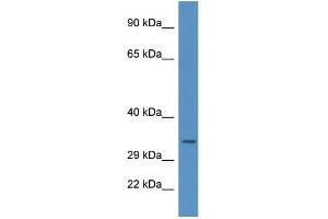 WB Suggested Anti-UNG AntibodyTitration: 1. (UNG 抗体  (C-Term))
