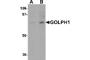 Western blot analysis of GOLPH1 in K562 cell lysate with GOLPH1 antibody at (A) 1 and (B) 2 µg/mL. (ACBD3 抗体  (N-Term))