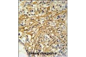 Immunohistochemistry (Paraffin-embedded Sections) (IHC (p)) image for anti-Chromosome 16 Open Reading Frame 61 (C16orf61) (AA 1-30), (N-Term) antibody (ABIN651108)