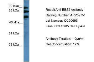 WB Suggested Anti-BBS2  Antibody Titration: 0. (BBS2 抗体  (Middle Region))