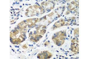 Immunohistochemistry of paraffin-embedded Human stomach using STX16 Polyclonal Antibody at dilution of 1:100 (40x lens). (Syntaxin 16 抗体)