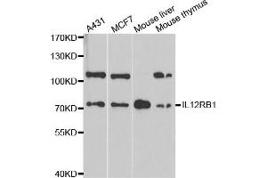 Western blot analysis of extracts of various cell lines, using IL12RB1 antibody. (IL12RB1 抗体)