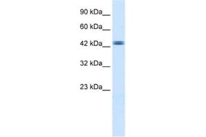 Western Blotting (WB) image for anti-tyrosyl-DNA phosphodiesterase 2 (TDP2) antibody (ABIN2460635)