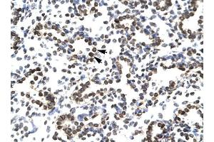 ZNF385 antibody was used for immunohistochemistry at a concentration of 4-8 ug/ml to stain Alveolar ceils (arrows) in Human Lung. (ZNF385A 抗体  (N-Term))