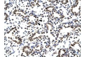 ZNF385 antibody was used for immunohistochemistry at a concentration of 4-8 ug/ml to stain Alveolar ceils (arrows) in Human Lung. (ZNF385A 抗体  (N-Term))