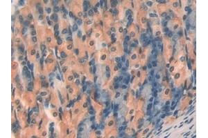 Detection of TBG in Mouse Stomach Tissue using Polyclonal Antibody to Thyroxine Binding Globulin (TBG) (SERPINA7 抗体  (AA 127-393))