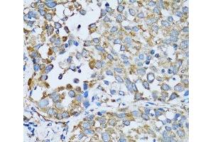Immunohistochemistry (Paraffin-embedded Sections) (IHC (p)) image for anti-Arginyl-tRNA Synthetase (RARS) antibody (ABIN7262114)