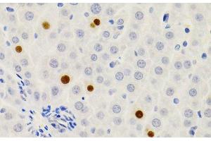 Immunohistochemistry of paraffin-embedded Rat liver using GEMIN2 Polyclonal Antibody at dilution of 1:200 (40x lens). (SIP1 抗体)