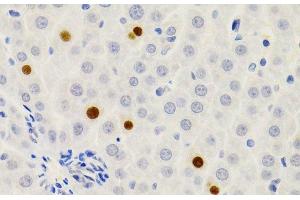 Immunohistochemistry of paraffin-embedded Rat liver using GEMIN2 Polyclonal Antibody at dilution of 1:200 (40x lens). (SIP1 抗体)