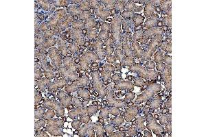 IHC analysis of SLC9A3R2 using anti-SLC9A3R2 antibody (ABIN7599271).