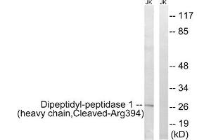 Western blot analysis of extracts from Jurkat cells, treated with etoposide (25uM, 1hour), using Dipeptidyl-peptidase 1 (heavy chain, Cleaved-Arg394) antibody. (CTSC 抗体  (C-Term))