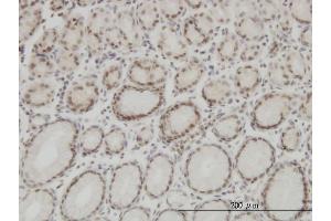 Immunoperoxidase of monoclonal antibody to HMGB1 on formalin-fixed paraffin-embedded human stomach. (HMGB1 抗体  (AA 1-215))